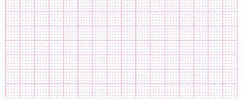 EKG-P., Hellige MicroSmart/ Mac 500, 360 Blatt [90 mm x 90 mm]