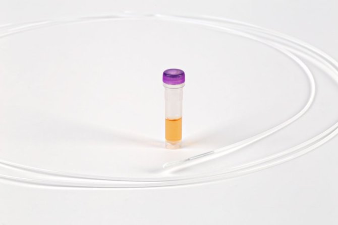 Pyromol-E-Testkid 1,7 mm 6 Stück