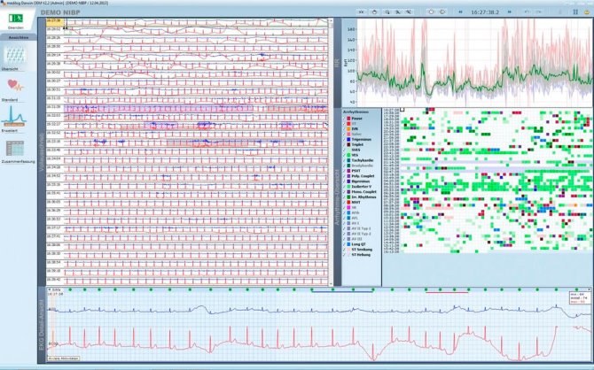 Schiller Darwin EKG-Arrhythmie-Analyse für Domino ( light)