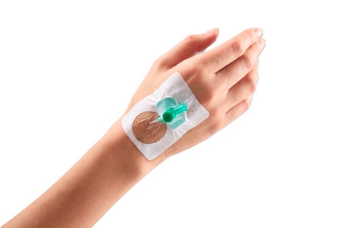 Curafix i.v. Control Kanülenfixierung, steril [6 x 7,5cm] [50 Stück]