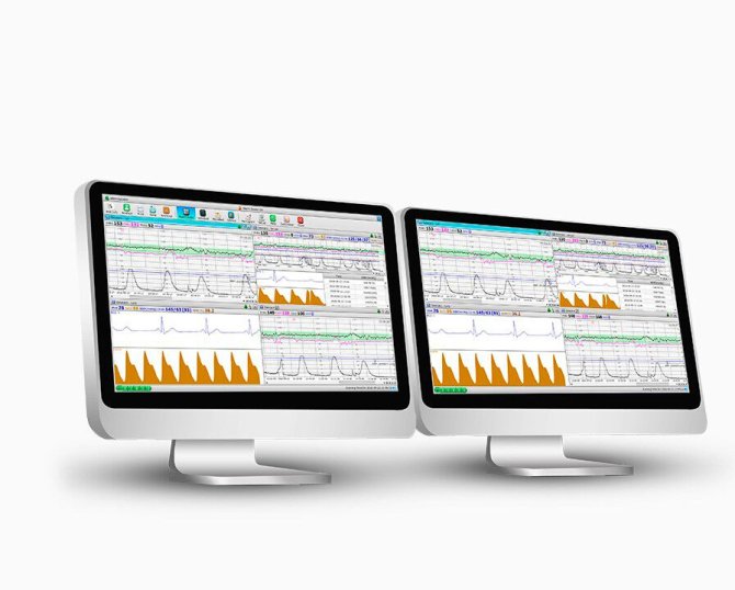 MFM-CNS Lite Central Monitoring Software Einzelarbeitsplastz Multi.CTG-Lizenz bis zu 6 CTGs anbindbar