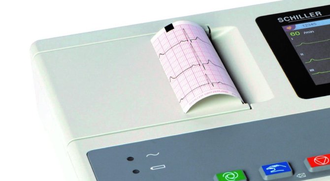 EKG Papier zu AT-1 G2 [70mm x 80mm x 25m]