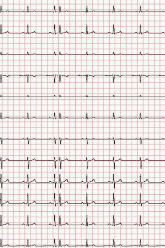 EKG-Papier zu Econet Medical, Cardio-M-Plus [210 mm x 30 m]