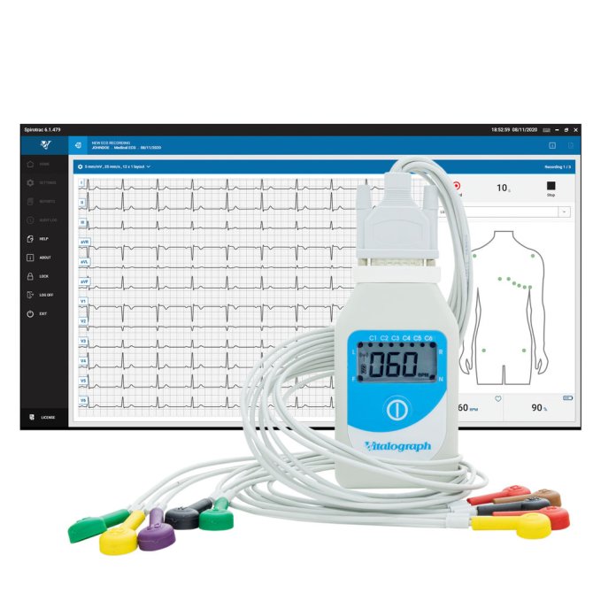 BT12 Ruhe-EKG mit Spirotrac 6 Software 12-Kanal- EKG inkl. GDT Schnittstelle und Netzwerklizenz für 5 Plätze