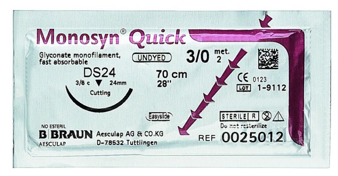 Monosyn Quick ungefärbt [3/0, metric 2, DS19, 45 cm] [36 Stück]