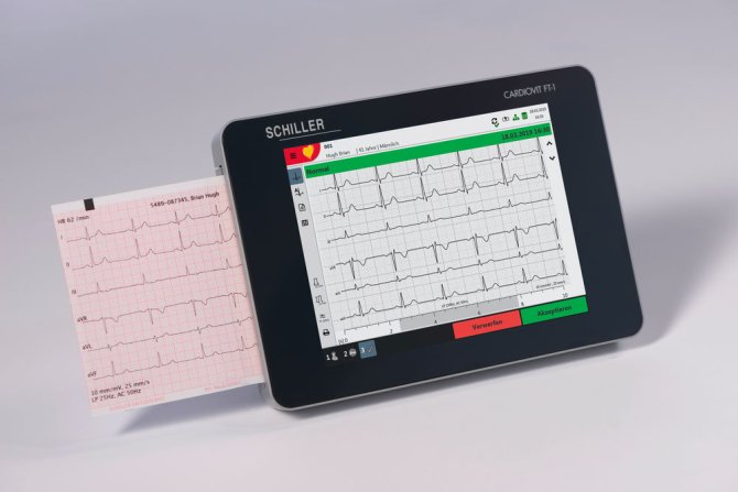 Cardiovit FT-1, Tablet EKG, inkl. Zubehör