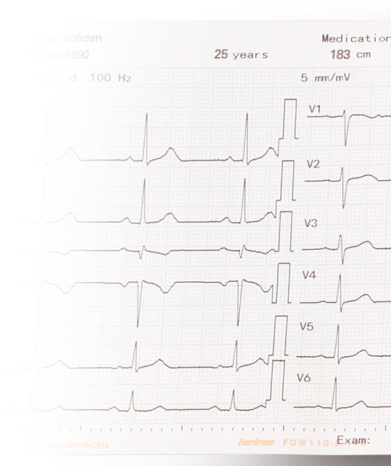 Registrierpapier gefaltet für EKG-9022G / EKG-1250G / 2250