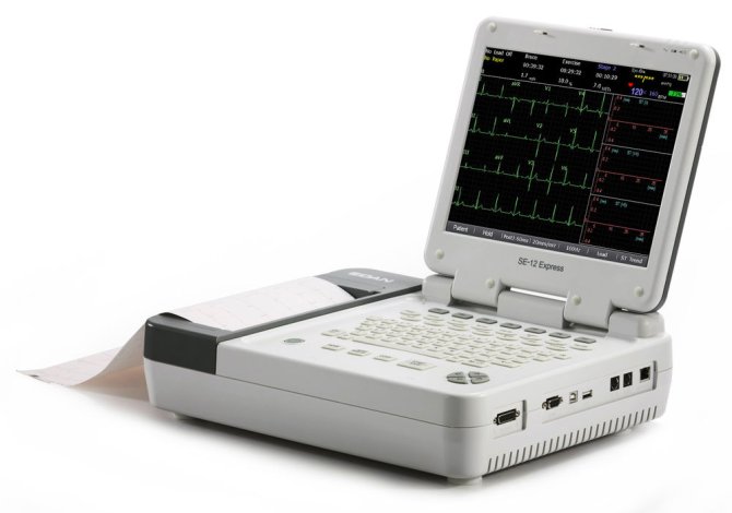 SE-12 Express, 12-Kanal-EKG Gerät mit Ergometrie Paket, Touchscreen, Patientenkabel, 6 Saug- und 4 Klammerelektroden, 1 Pckg. Papier 100 Blatt, Lithium Akku