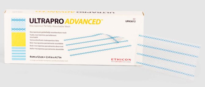 Ultrapro Advanced Herniennetz [30 x 30 cm]