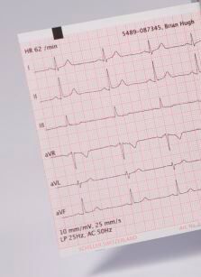 High Q EKG-Papier zu Cardiovit FT-1 2.157037 60 Blatt