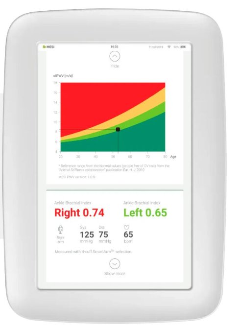 PWV APP Pulswellengeschwindigkeit